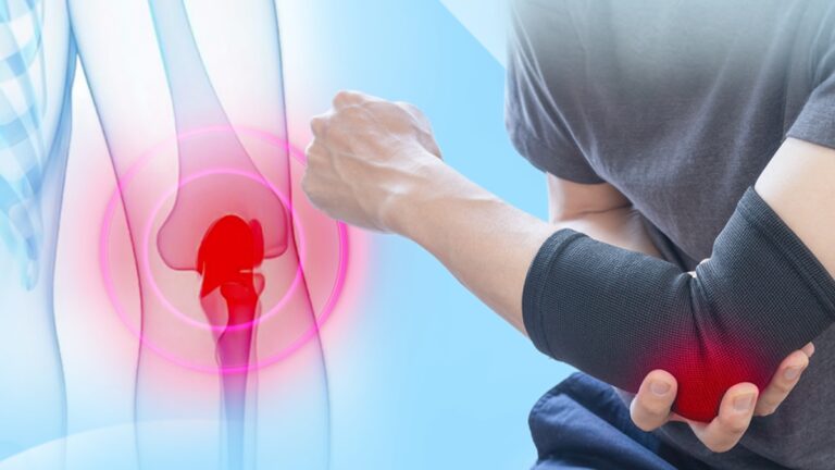 chơi pickleball đau khuỷu tay: hiểu và cách khắc phục