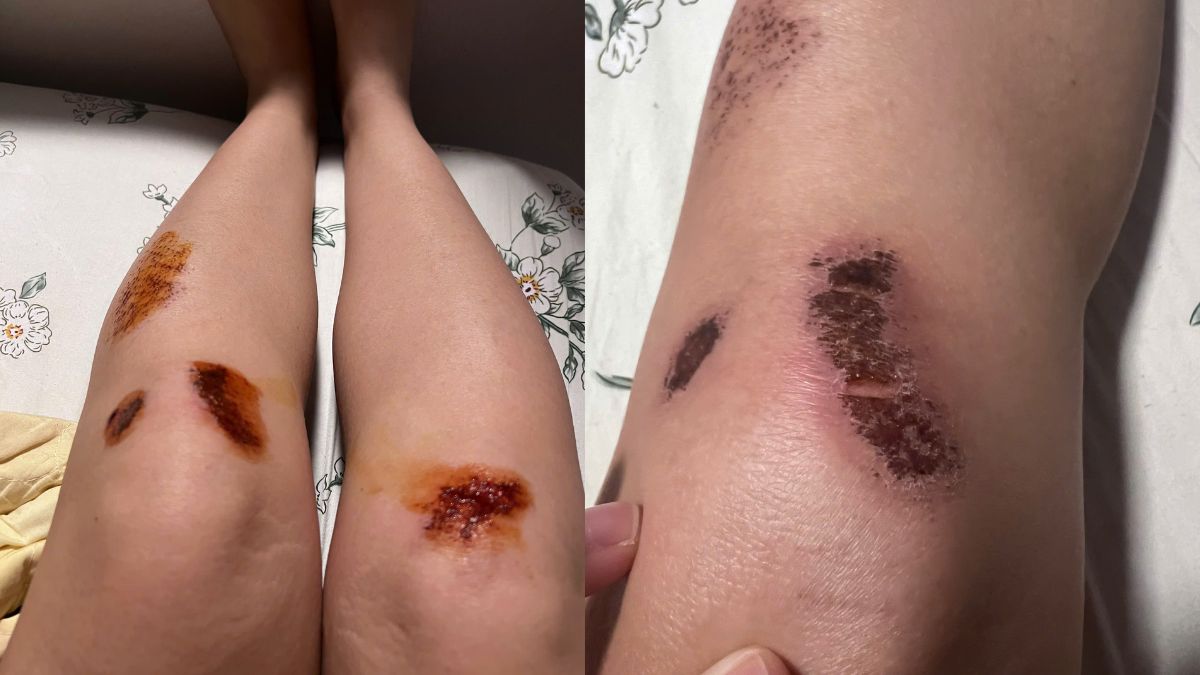 dân văn phòng nghiện pickleball: đam mê “đau nhưng vẫn ham”