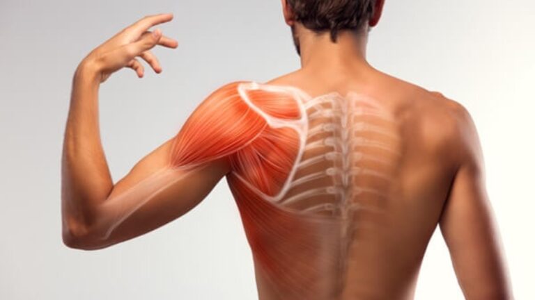 xử lý dứt điểm cơn đau vai khi chơi pickleball