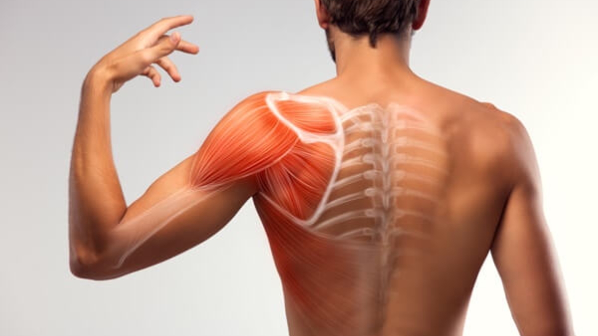 xử lý dứt điểm cơn đau vai khi chơi pickleball