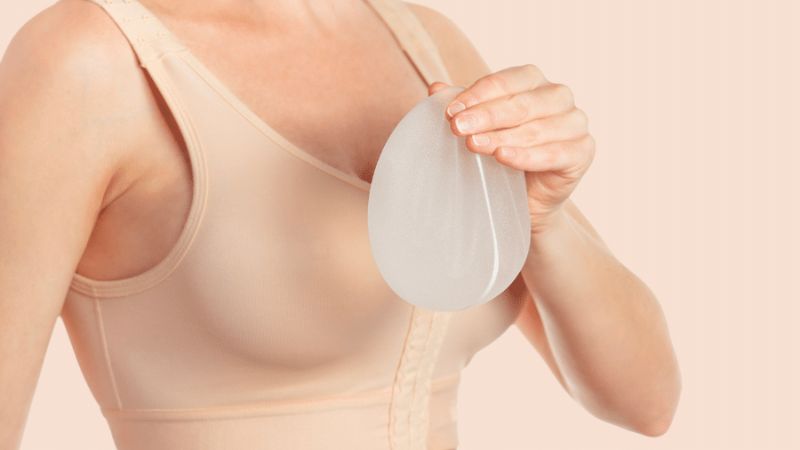 Vị trí đặt túi ngực dưới cơ hay trên cơ quyết định khả năng vận động sau phẫu thuật